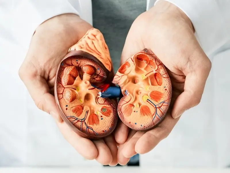 o que é calculo renal e quais os sintomas