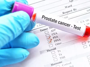 Quando o PSA é preocupante: cuidados e como agir?